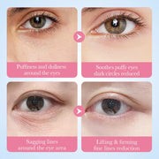 Masque Yeux au Collagène Sakura – Anti-Cernes, Anti-Poches & Hydratation