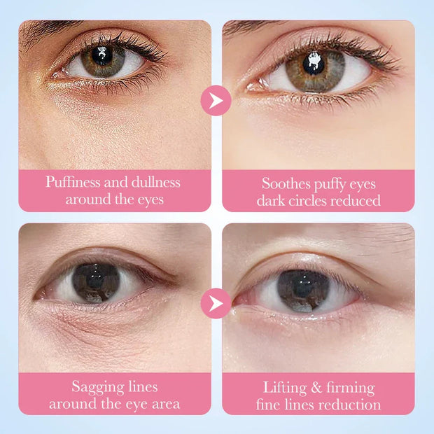 Masque Yeux au Collagène Sakura – Anti-Cernes, Anti-Poches & Hydratation