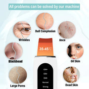 Appareil de Nettoyage Visage Ultrasonique – 5 Modes, LED Rouge & Bleue, Exfoliation et Lifting