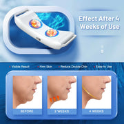 Appareil Raffermissant Visage V-Line – EMS Double Menton | Modèle Chauffant ou Standard