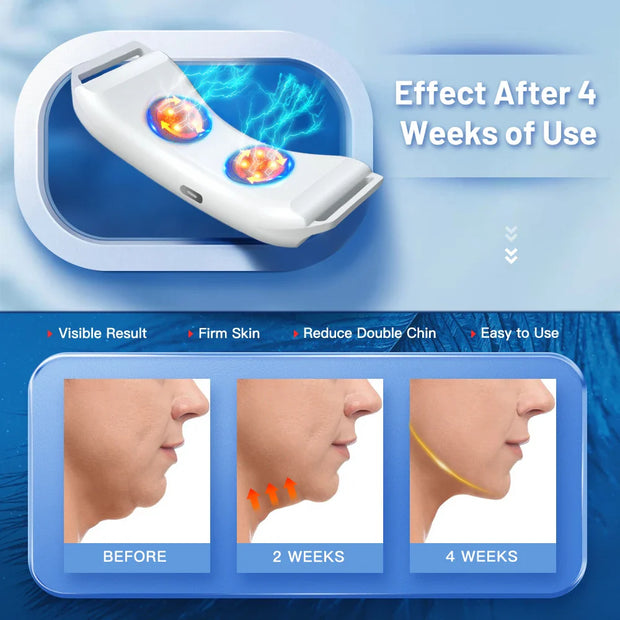Appareil Raffermissant Visage V-Line – EMS Double Menton | Modèle Chauffant ou Standard