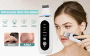 Appareil de Nettoyage Visage Ultrasonique – 5 Modes, LED Rouge & Bleue, Exfoliation et Lifting