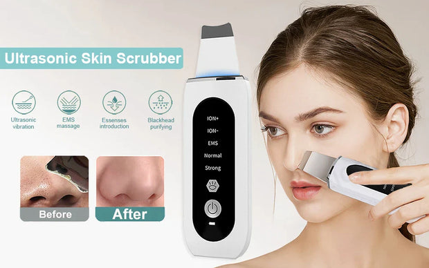 Appareil de Nettoyage Visage Ultrasonique – 5 Modes, LED Rouge & Bleue, Exfoliation et Lifting